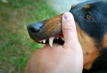 What Should You Do After a Dog Attack? Medical Steps and Legal Advice What Should You Do After a Dog Attack? Medical Steps and Legal Advice