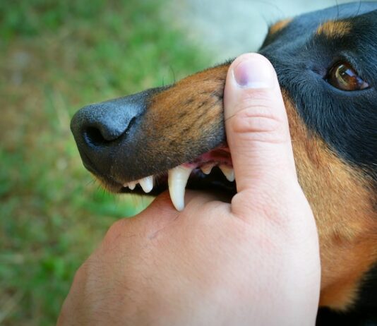 What Should You Do After a Dog Attack? Medical Steps and Legal Advice What Should You Do After a Dog Attack? Medical Steps and Legal Advice