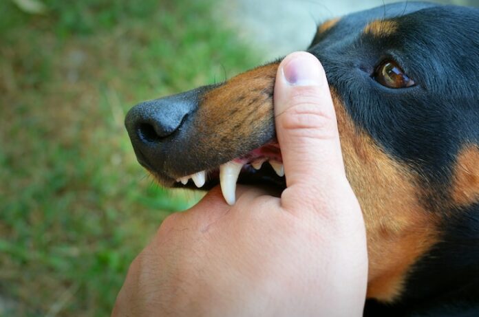 What Should You Do After a Dog Attack? Medical Steps and Legal Advice